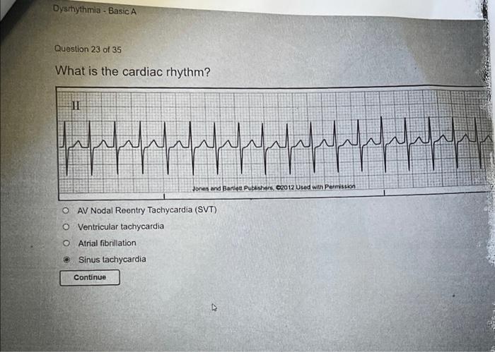 Relias dysrhythmia - basic b test answers course hero