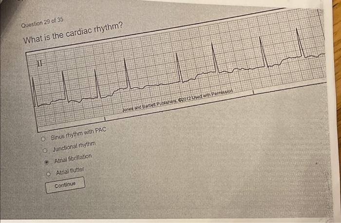 Relias dysrhythmia - basic b test answers course hero