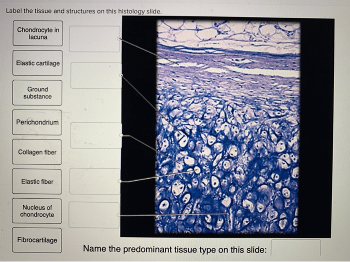 Adipose label slide structures tissue connective lipid nucleus adipocyte inclusion capillary