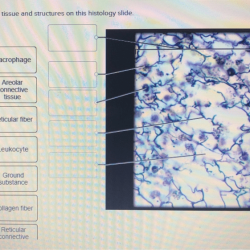 Histology lung respiratory labeled alveoli bronchiole alveolar duct cell lungs pulmonary anatomy tissue