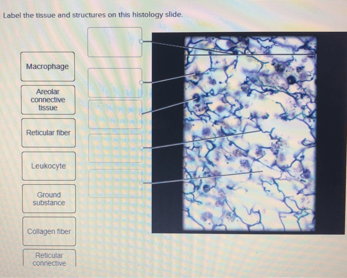 Histology lung respiratory labeled alveoli bronchiole alveolar duct cell lungs pulmonary anatomy tissue