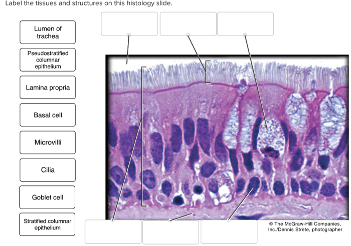 Label the structures and tissues on this histology slide