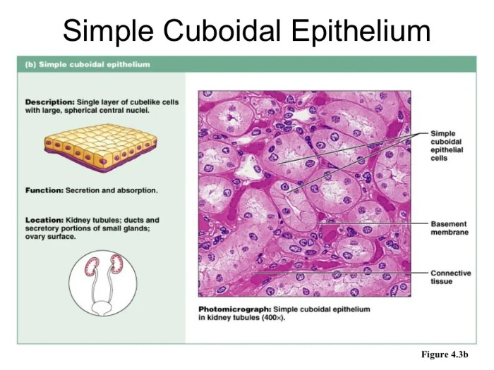 Label the structures and tissues on this histology slide